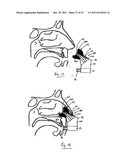 NASAL DELIVERY diagram and image