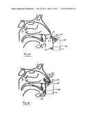 NASAL DELIVERY diagram and image