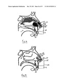 NASAL DELIVERY diagram and image