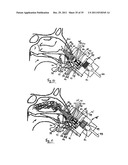 NASAL DELIVERY diagram and image