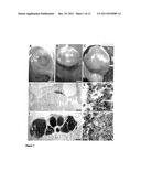 HUMAN PANCREATIC BETA CELL LINES FOR DIAGNOSTIC OF DIABETES diagram and image