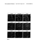 HUMAN PANCREATIC BETA CELL LINES FOR DIAGNOSTIC OF DIABETES diagram and image