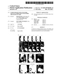 TUMOR THERAPY WITH ANTITUMOR AGENTS IN COMBINATION WITH SINDBIS     VIRUS-BASED VECTORS diagram and image