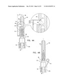 DENTAL IMPLANT HAVING A RECESSED SURFACE FOR SEALING diagram and image