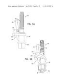 DENTAL IMPLANT HAVING A RECESSED SURFACE FOR SEALING diagram and image