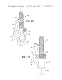 DENTAL IMPLANT HAVING A RECESSED SURFACE FOR SEALING diagram and image