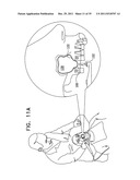 DENTAL IMPLANT HAVING A RECESSED SURFACE FOR SEALING diagram and image