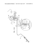 DENTAL IMPLANT HAVING A RECESSED SURFACE FOR SEALING diagram and image