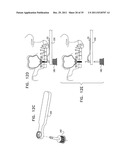 DENTAL IMPLANT HAVING A RECESSED SURFACE FOR SEALING diagram and image