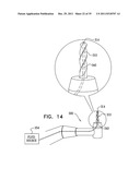 DENTAL IMPLANT HAVING A RECESSED SURFACE FOR SEALING diagram and image