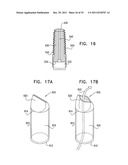 DENTAL IMPLANT HAVING A RECESSED SURFACE FOR SEALING diagram and image