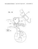 DENTAL IMPLANT HAVING A RECESSED SURFACE FOR SEALING diagram and image