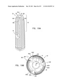 DENTAL IMPLANT HAVING A RECESSED SURFACE FOR SEALING diagram and image