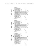 DENTAL IMPLANT HAVING A RECESSED SURFACE FOR SEALING diagram and image