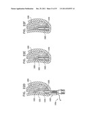 DENTAL IMPLANT HAVING A RECESSED SURFACE FOR SEALING diagram and image