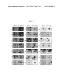 METHOD OF SCREENING PLACENTAL PROTEINS RESPONSIBLE FOR PATHOPHYSIOLOGY OF     PREECLAMPSIA, AND MARKER FOR EARLY DIAGNOSIS AND PREDICTION OF     PREECLAMPSIA diagram and image