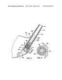 GOLF CLUB diagram and image