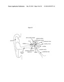 Controlled Release Corticosteroid Compositions and Methods for the     Treatment of Otic Disorders diagram and image