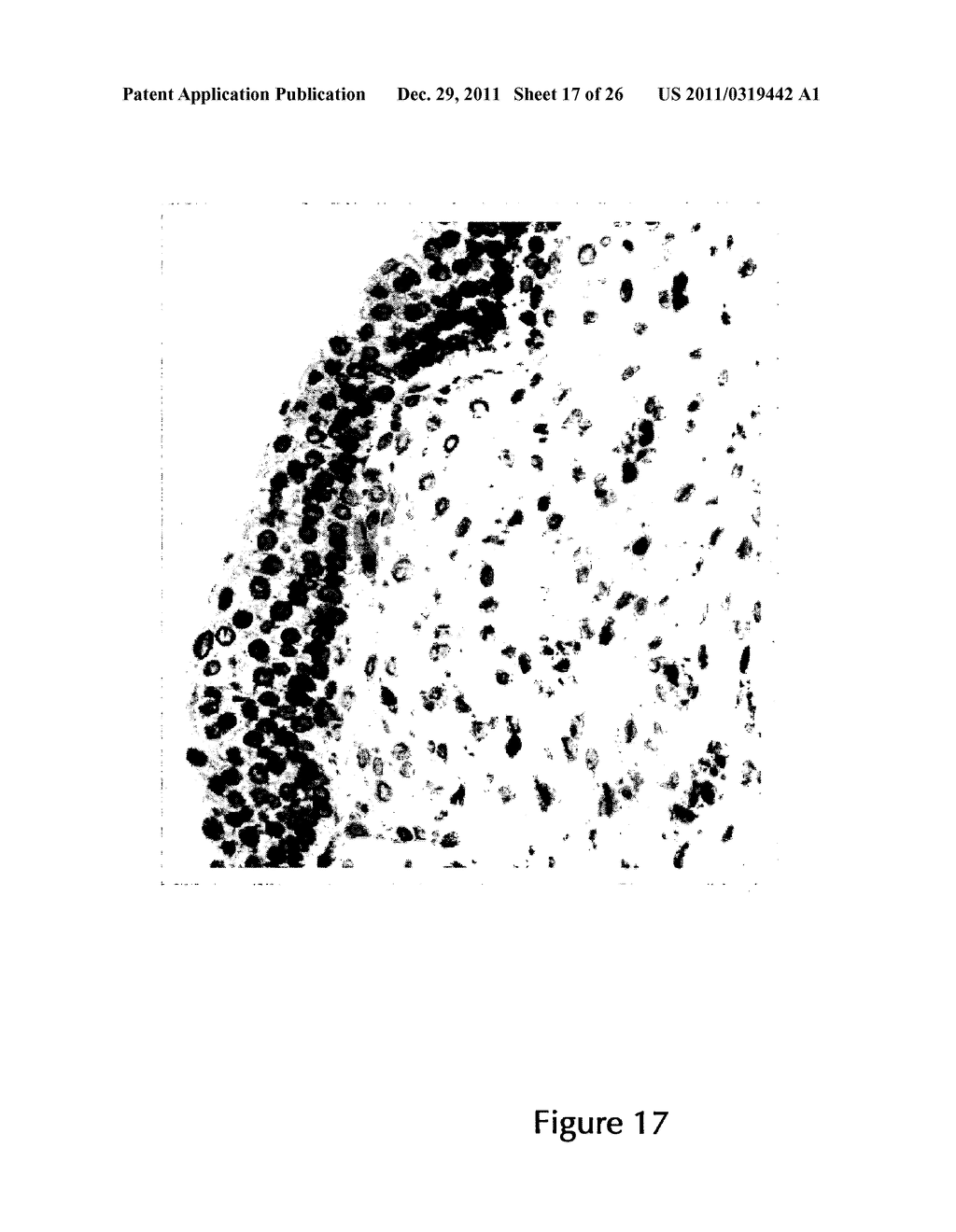 PHARMACEUTICAL COMPOSITIONS COMPRISING IMIDAZOQUINOLIN(AMINES) AND     DERIVATIVES THEREOF SUITABLE FOR LOCAL ADMINISTRATION - diagram, schematic, and image 18