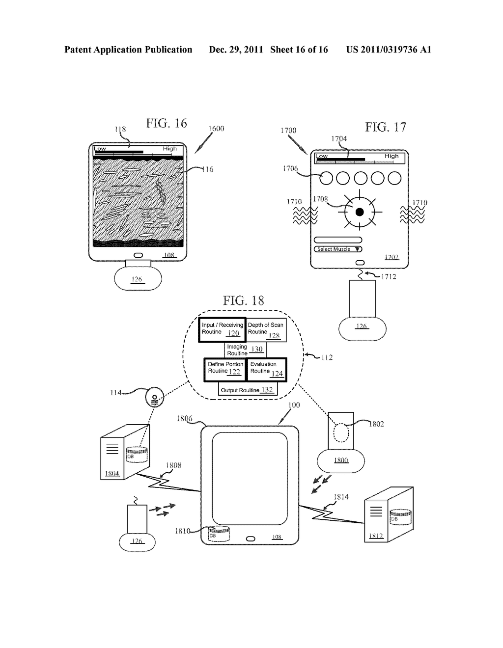 SYSTEM FOR NON-INVASIVE DETERMINATION OF GLYCOGEN STORES - diagram, schematic, and image 17