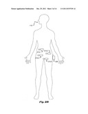 System and Method for Determining Medical Capsule Location inside a Human     Body diagram and image