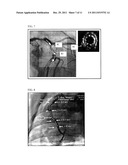 IMAGE SUPER ENHANCEMENT diagram and image