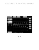 Multipurpose Host System for Invasive Cardiovascular Diagnostic     Measurement Acquisition Including an Enhanced Dynamically Configured     Graphical Display diagram and image