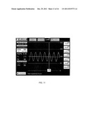 Multipurpose Host System for Invasive Cardiovascular Diagnostic     Measurement Acquisition Including an Enhanced Dynamically Configured     Graphical Display diagram and image