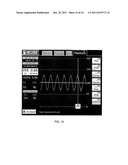 Multipurpose Host System for Invasive Cardiovascular Diagnostic     Measurement Acquisition Including an Enhanced Dynamically Configured     Graphical Display diagram and image