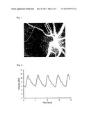 BLOOD FLOW IMAGE DIAGNOSING DEVICE diagram and image