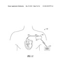 RHYTHM DISCRIMINATION USING INFORMATION INDICATIVE OF LEAD MOTION diagram and image