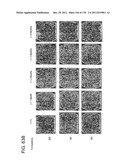 COMBINATION THERAPY WITH CRYOSURGERY AND LOW DOSAGE STRENGTH IMIQUIMOD TO     TREAT ACTINIC KERATOSIS diagram and image