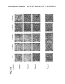 COMBINATION THERAPY WITH CRYOSURGERY AND LOW DOSAGE STRENGTH IMIQUIMOD TO     TREAT ACTINIC KERATOSIS diagram and image