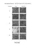 COMBINATION THERAPY WITH CRYOSURGERY AND LOW DOSAGE STRENGTH IMIQUIMOD TO     TREAT ACTINIC KERATOSIS diagram and image