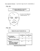 COMBINATION THERAPY WITH CRYOSURGERY AND LOW DOSAGE STRENGTH IMIQUIMOD TO     TREAT ACTINIC KERATOSIS diagram and image