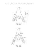 FIBER OPTIC INSTRUMENT SENSING SYSTEM diagram and image