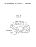 Red Light Implants for Treating Postpartum Depression diagram and image