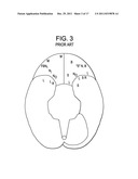 Red Light Implants for Treating Postpartum Depression diagram and image