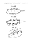 Flexible Vertebral Body Shavers diagram and image