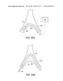 METHODS AND DEVICES FOR CONTROLLING A SHAPEABLE INSTRUMENT diagram and image