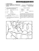 Side-loading interspinous process spacer an installation tool diagram and image