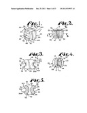 Side-loading interspinous process spacer an installation tool diagram and image