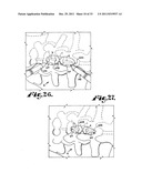 Side-loading interspinous process spacer an installation tool diagram and image