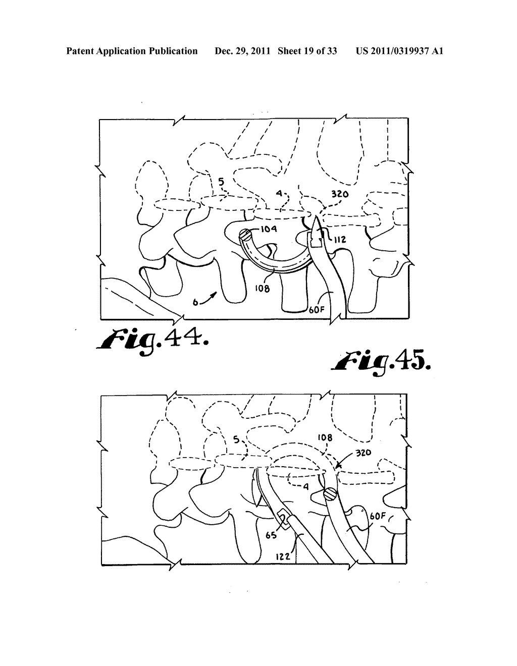 Side-loading interspinous process spacer an installation tool - diagram, schematic, and image 20