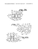 Side-loading interspinous process spacer an installation tool diagram and image