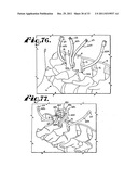 Side-loading interspinous process spacer an installation tool diagram and image