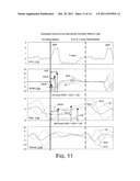 METRICS AND TECHNIQUES FOR OPTIMIZATION OF CARDIAC THERAPIES diagram and image