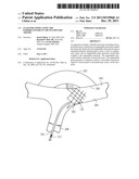 LEAD FOR STIMULATING THE BARORECEPTORS IN THE PULMONARY ARTERY diagram and image