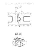 Multi-Segment Lateral Cage Adapted to Flex Substantially in the Coronal     Plane diagram and image