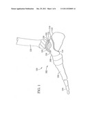 System and Method for Ankle Arthroplasty diagram and image